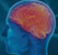 Publication : De l'humeur normale à la dépression en psychologie cognitive, neurosciences et psychiatrie